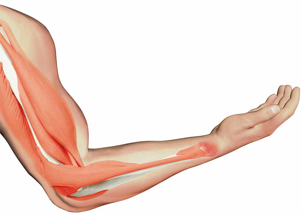 Muscle Spasms In Arm 25